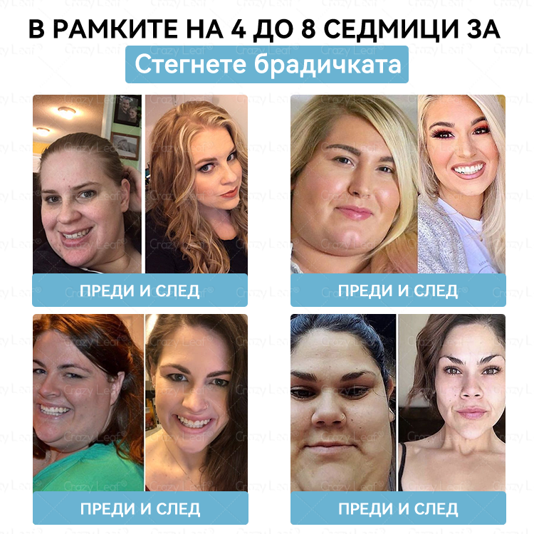 CrazyLeaf® Слим & Виталити Тирезепатид 8 в 1 – ❖ орален разтвор (Само веднъж на ден – видими резултати само за 7 дни) ✅ Подходящ за различни нужди: наднормено тегло, сърдечно-съдово здраве, диабет, сънна апнея, здраве на червата, ставни проблеми и други.