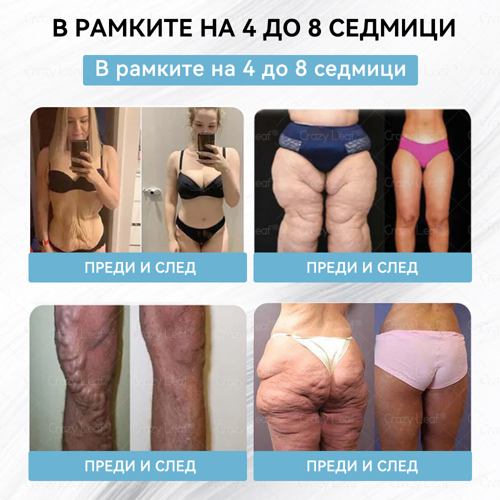 CrazyLeaf® Слим & Виталити Тирезепатид 8 в 1 – ❖ орален разтвор (Само веднъж на ден – видими резултати само за 7 дни) ✅ Подходящ за различни нужди: наднормено тегло, сърдечно-съдово здраве, диабет, сънна апнея, здраве на червата, ставни проблеми и други.
